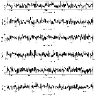 Counts Spectrum (3)_SN 1987A_obsid_18808