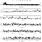 Counts Spectrum (1)_SN 1987A_obsid_18808