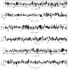 Counts Spectrum (2)_SN 1987A_obsid_17898