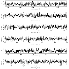 Counts Spectrum (3)_SN 1987A_obsid_17898
