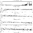 Flux spectrum (1)_4U 0513-40 (in NGC 1851)_obsid_18759