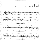 Flux spectrum (1)_4U 0513-40 (in NGC 1851)_obsid_18758