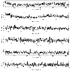 Counts Spectrum (2)_Mrk 421_obsid_19855