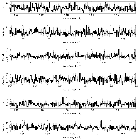 Counts Spectrum (3)_Mrk 421_obsid_19855