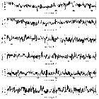 Counts Spectrum (2)_Mrk 421_obsid_19859