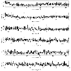 Counts Spectrum (2)_Mrk 421_obsid_19857