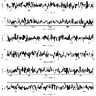 Counts Spectrum (3)_Mrk 421_obsid_19857