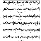 Counts Spectrum (2)_Nova Lup 2016_obsid_20632