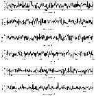 Counts Spectrum (3)_Nova Lup 2016_obsid_20632