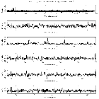 Counts Spectrum (1)_tau Boo_obsid_20019