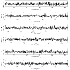 Counts Spectrum (2)_SN 1987A_obsid_19290