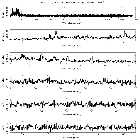Counts Spectrum (1)_SN 1987A_obsid_19290