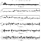 Counts Spectrum (1)_SN 1987A_obsid_20036