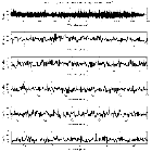 Counts Spectrum (1)_NGC 3516_obsid_19520