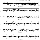 Counts Spectrum (1)_NGC 3516_obsid_20904