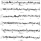 Counts Spectrum (3)_Mrk 421_obsid_20943