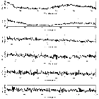 Counts Spectrum (2)_Mrk 421_obsid_19444