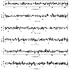 Counts Spectrum (2)_RX J2143.0+0654_obsid_20748