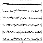 Counts Spectrum (1)_PKS 0405-123_obsid_21955