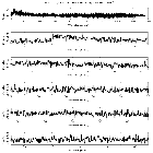 Counts Spectrum (1)_PKS 0405-123_obsid_21389
