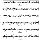 Counts Spectrum (3)_SN 1987A_obsid_22156