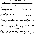 Counts Spectrum (1)_SN 1987A_obsid_22156