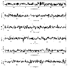 Counts Spectrum (2)_SN 1987A_obsid_22155