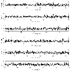 Counts Spectrum (2)_mu Lep_obsid_3764
