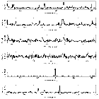 Counts Spectrum (2)_Capella_obsid_24839