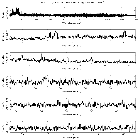 Counts Spectrum (1)_SN 1987A_obsid_23198