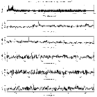 Counts Spectrum (1)_SN 1987A_obsid_22424