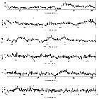 Counts Spectrum (2)_V 1674 Her_obsid_25092