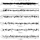 Counts Spectrum (1)_RX J0859.1+0537_obsid_24764