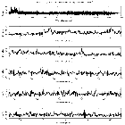 Counts Spectrum (1)_SN 1987A_obsid_23533