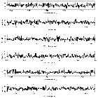 Counts Spectrum (3)_SN 1987A_obsid_24653