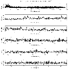 Counts Spectrum (1)_SN 1987A_obsid_24653