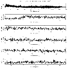 Counts Spectrum (1)_H 1821+643_obsid_22469