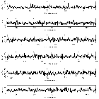 Counts Spectrum (3)_SN 1987A_obsid_27807