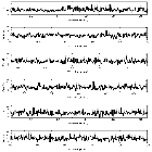 Counts Spectrum (2)_SN 1987A_obsid_25511