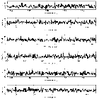 Counts Spectrum (3)_SN 1987A_obsid_25511