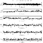 Counts Spectrum (1)_SN 1987A_obsid_25511