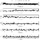 Counts Spectrum (1)_SN 1987A_obsid_28755