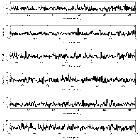 Counts Spectrum (2)_SN 1987A_obsid_25513