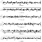 Counts Spectrum (3)_SN 1987A_obsid_25513