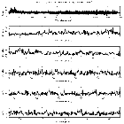 Counts Spectrum (1)_SN 1987A_obsid_25513